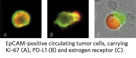 EpCAM-positive circulating tumor cells, carrying Ki-67 (A), PD-L1 (B), and estrogen receptor (C).
