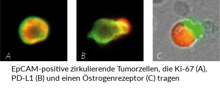 EpCAM-positive zirkulierende Tumorzellen, die Ki-67, PD-L1 und einen Östrogenrezeptor tragen