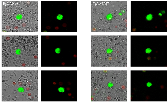 CTECs / CTCs Bildergallerie