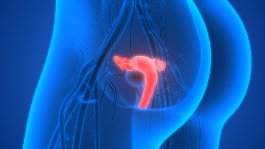 maintrac® for ovarian cancer (Carcinoma of the ovaries)